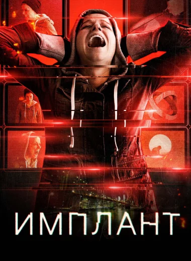 Имплант