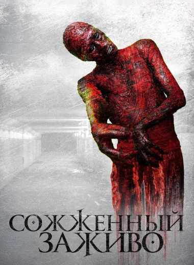 Сожженный заживо