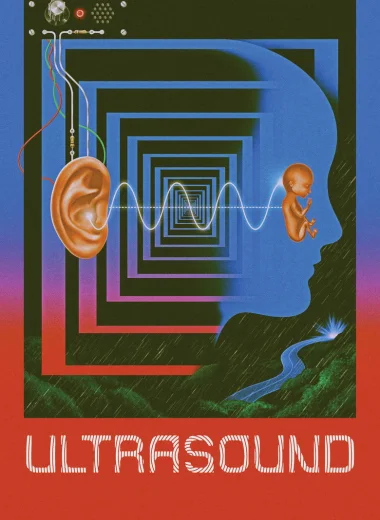 Ультразвук